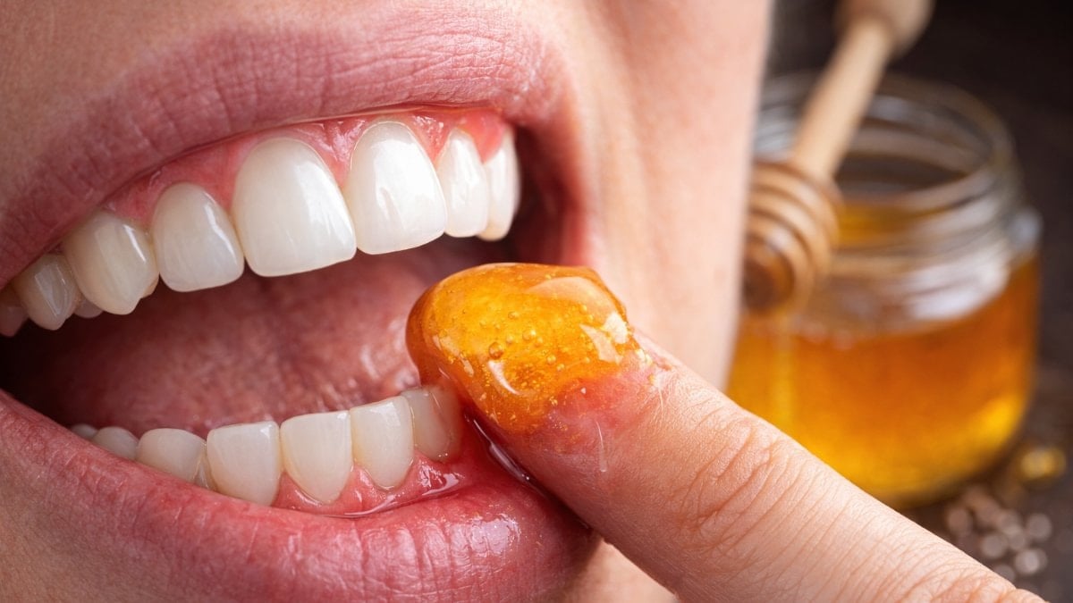 Diş etlerine bal sürmek dişçiden kurtarıyor…