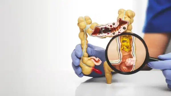 Bağırsak sağlığı için en kötü gıdalar neler?