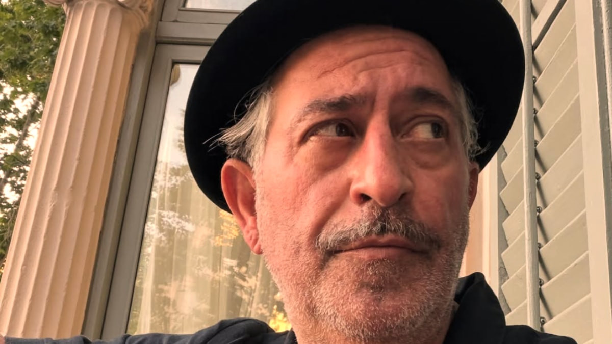 Cem Yılmaz’ın son hali şaşırttı